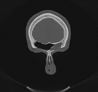 Another alt text